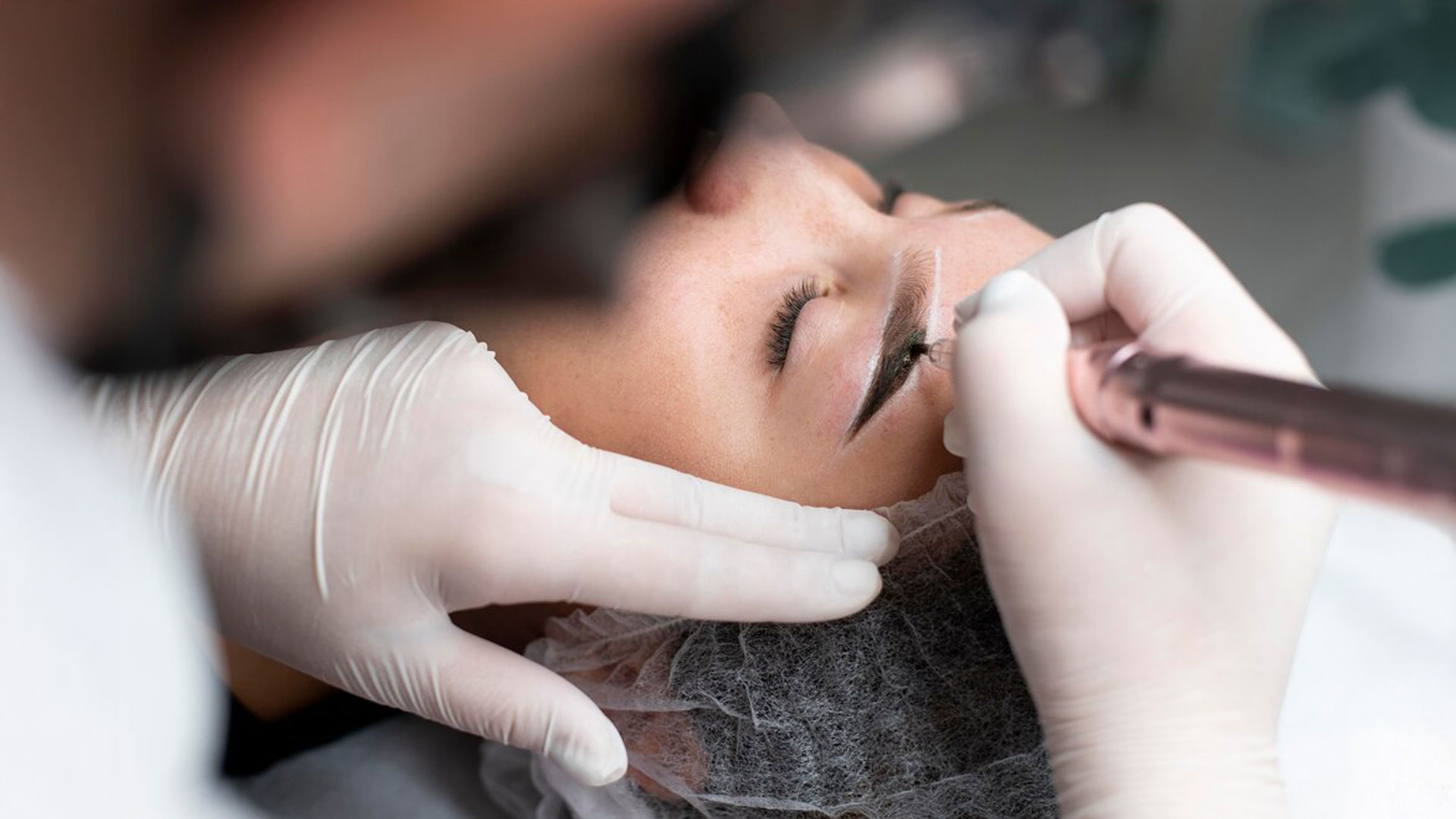Eyebrow Transplant