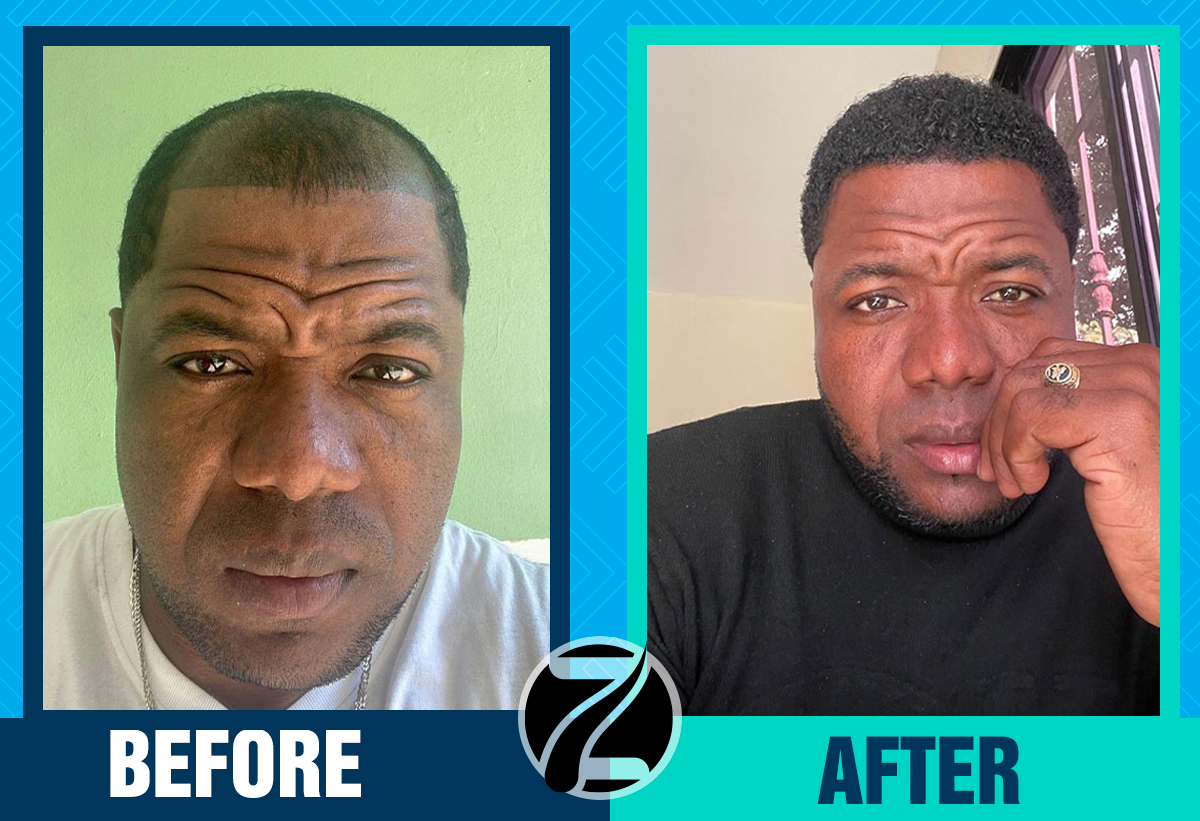 Before After